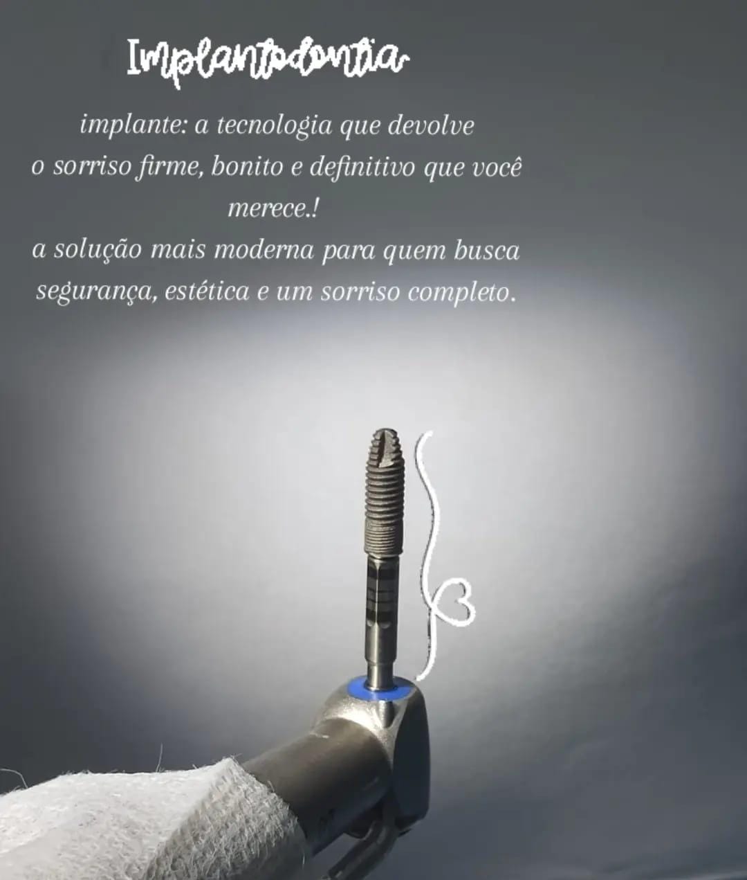 Implante dentário: tecnologia para um sorriso firme, bonito e definitivo